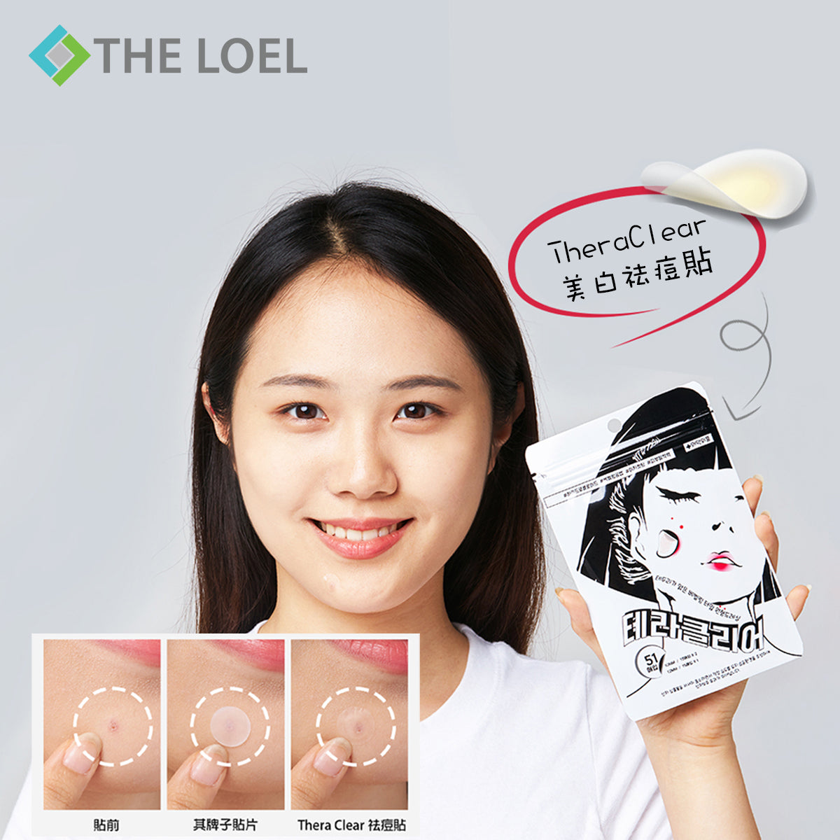 The Loel - Thera Clear 美白祛痘貼 (51片) Wet Band Acne Patch